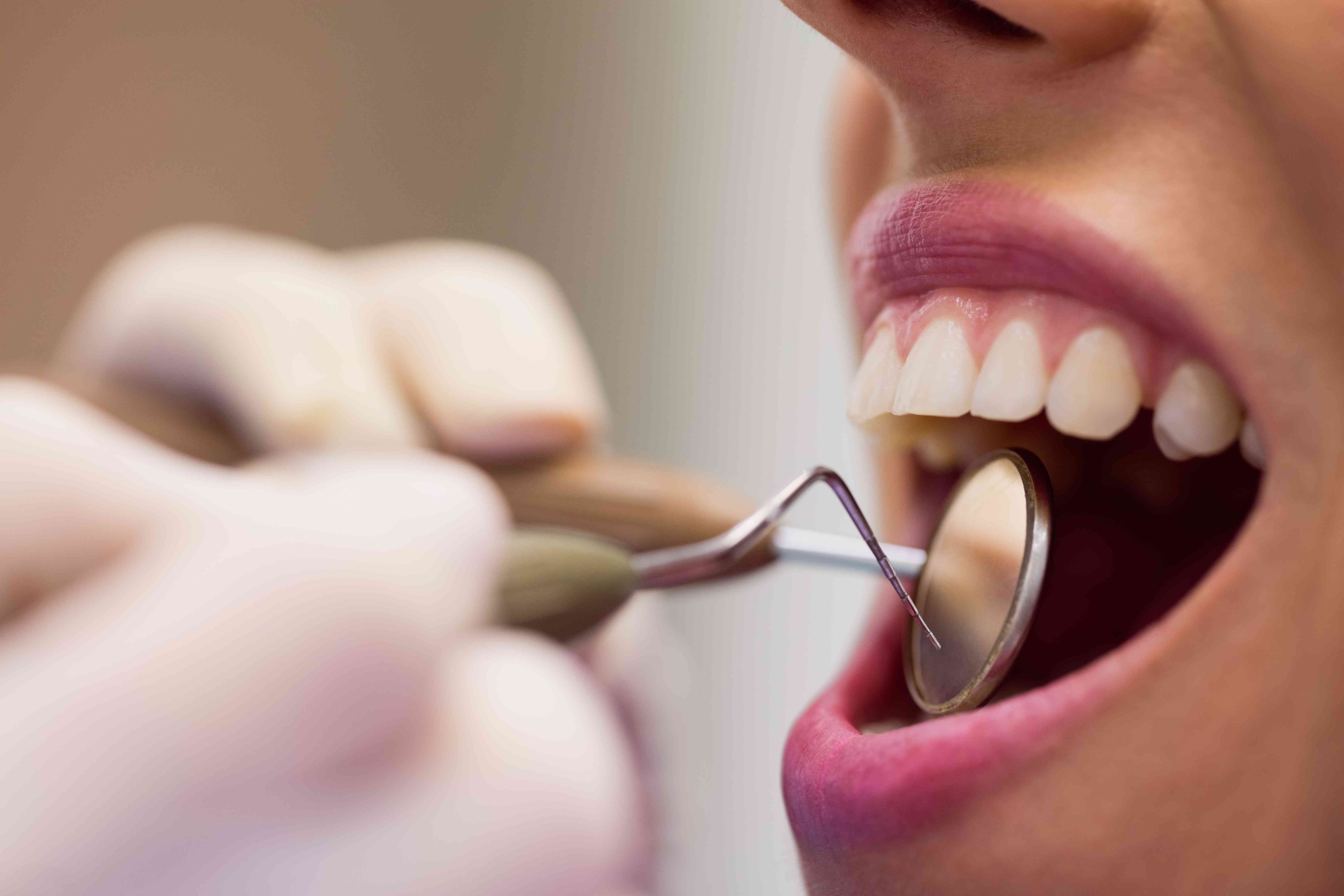 Periodontal treatment showing healthy gums